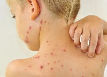 Қызылшаның қауіпі жоғары