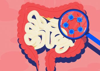 Тамақтан уланып қалмаңыз!