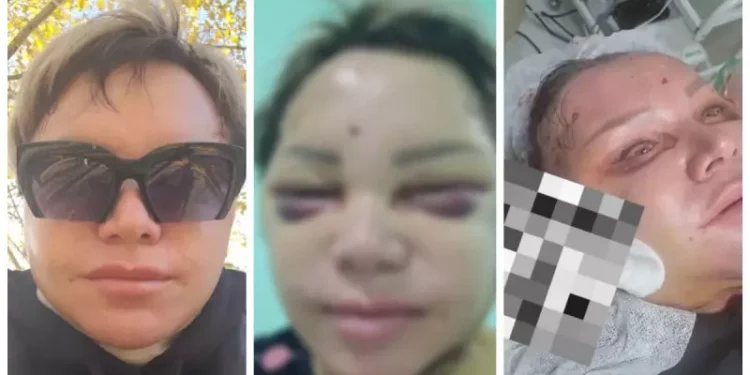 Сұлулық салонына барған көкшетаулық тұрғын мерт бола жаздаған