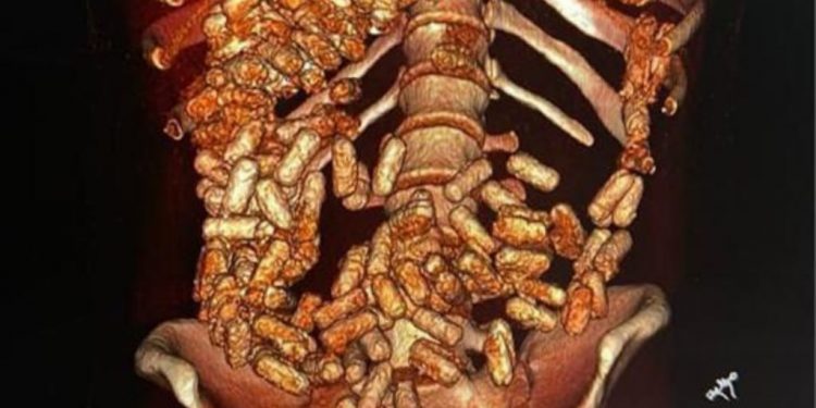 ҰҚК АҚТАУ ӘУЕЖАЙЫНДА 2 КГ ЕСІРТКІ “ЖҰТҚАН” ЕР АДАМ ҰСТАЛДЫ