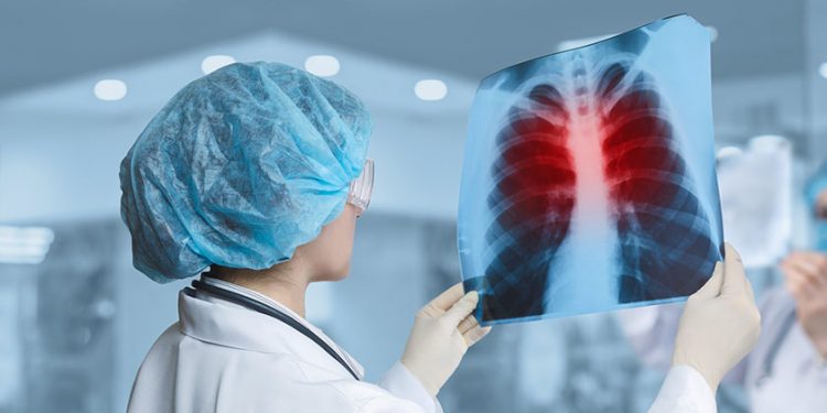 Туберкулез ауруын алдын алу шаралары