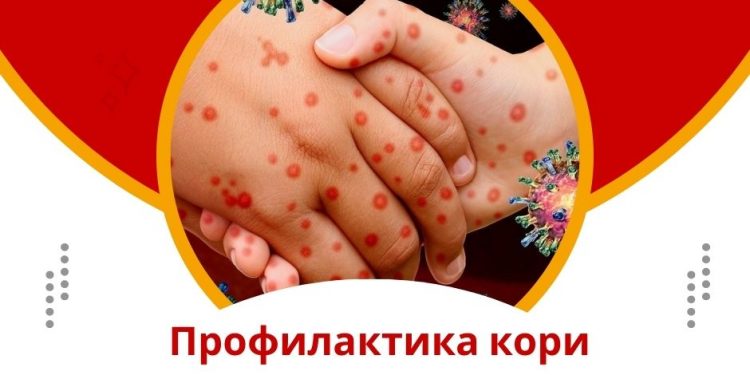 Профилактика кори