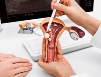 Профилактика эндометрита