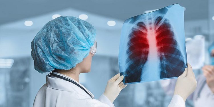 Туберкулезді алдын алу жолдары қандай?