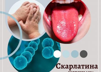 Скарлатина — инфекциялық жұқпалы ауру