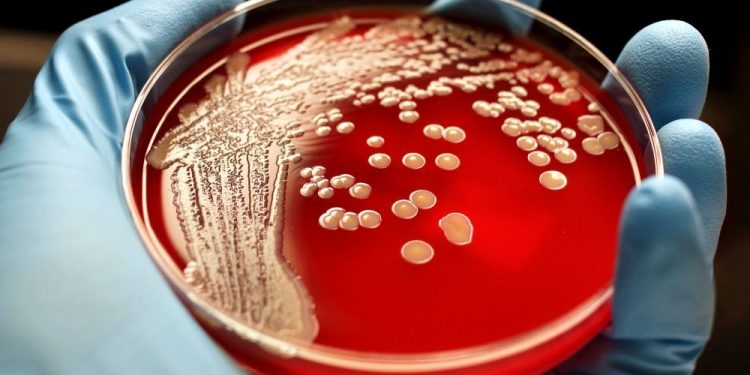 СІБІР ЖАРАСЫ: АУРУДЫҢ БЕЛГІЛЕРІ МЕН АЛДЫН АЛУ ШАРАЛАРЫ