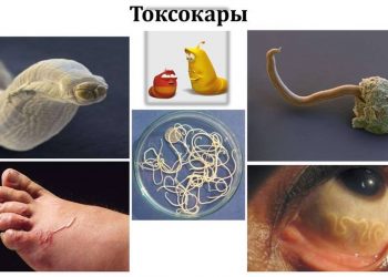 Токсокароздың адам денсаулығына қауіптілігі қандай?