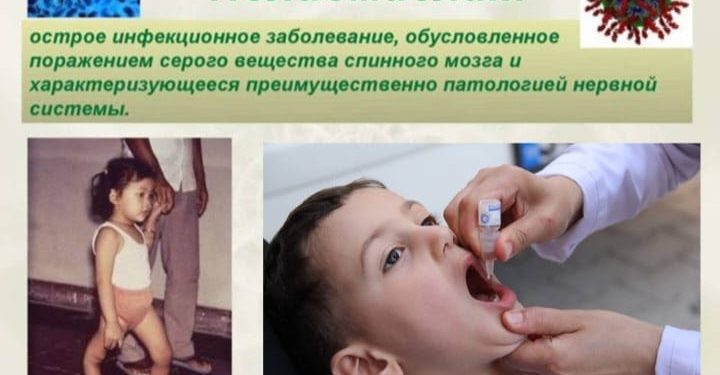 Полиомиелит – полиовирус әсерінен болатын жедел жұқпалы ауру