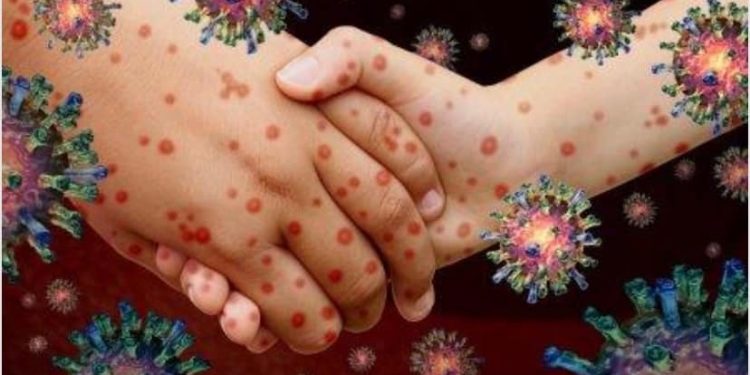 Қызылша ауруының  алдын алу