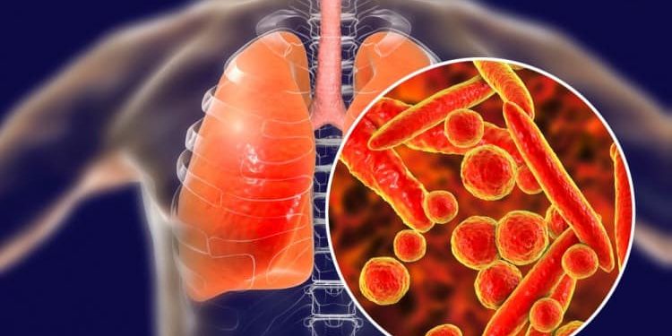 ТУБЕРКУЛЕЗДЕН САҚТАНАЙЫҚ!