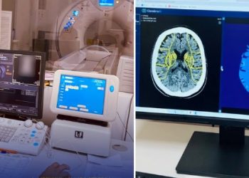 Шымкент медицинасында жасанды интеллект дәуірі басталды: CEREBRA жүйесі инсультті ерте анықтауға мүмкіндік береді